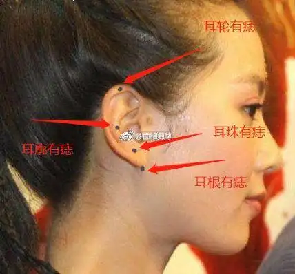 1耳珠有痣主财耳珠有痣者财运不错,但. 来自女性夜谈 - 微博