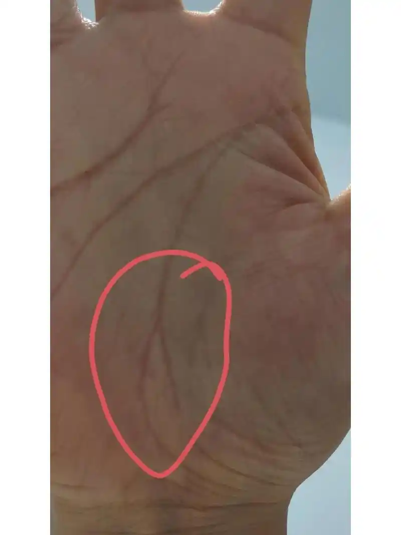 生命线分叉,注意精神方面的疫病 生命线分叉,注意精神方面的疫病