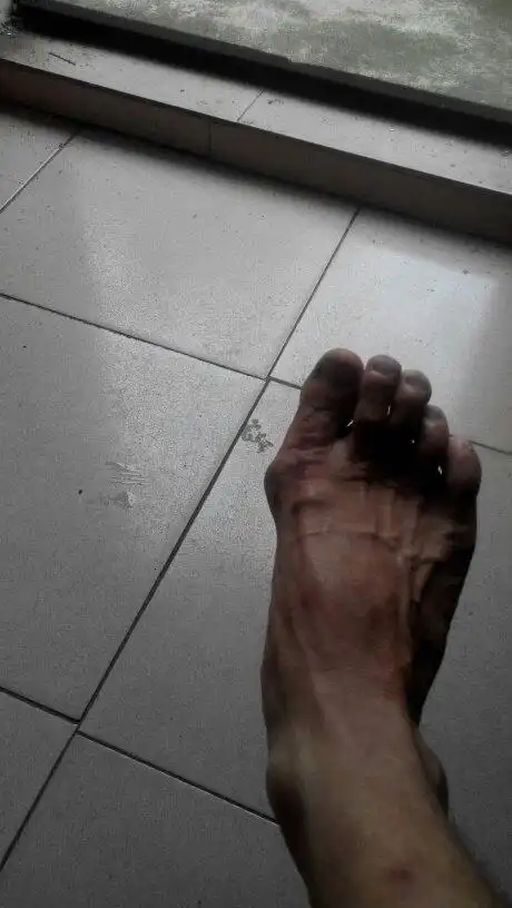 此样脚型穿皮鞋难看!穿啥鞋才好? 听说还命苦,真的吗?