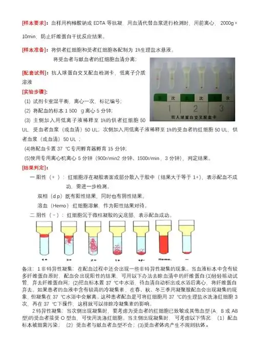 交叉配血卡操作规程doc