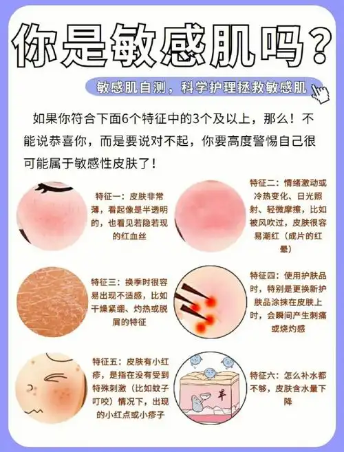 敏感肌自测73告别敏感肌