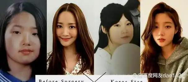 14位韩国女明星整形前后对比照,整容前后变化