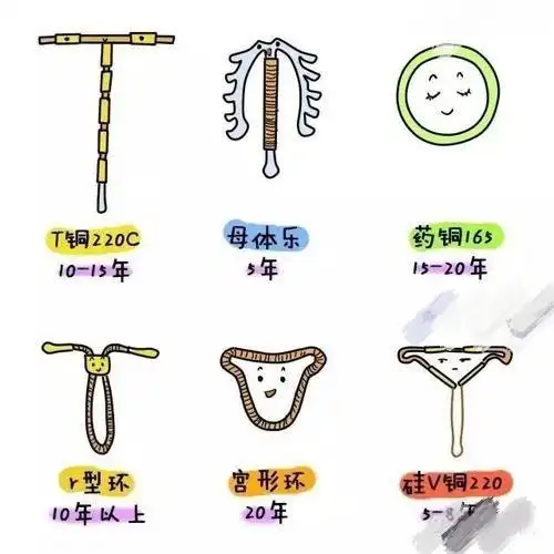 避孕环的避孕原理是怎样的有动画图吗