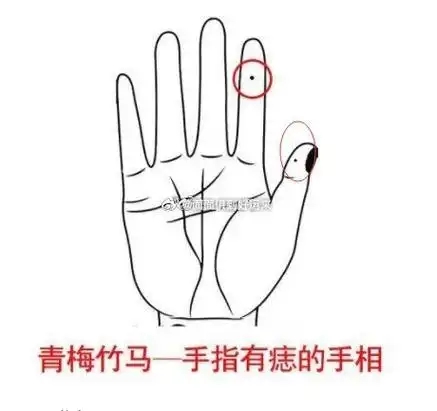 在相学中大拇指和食指有痣的人,代表着父母是自己的贵人,并且父母都