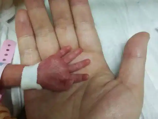 9斤的小胖崽生出来的宝宝一般在6,7斤胎儿分娩的最佳时机应该为37周