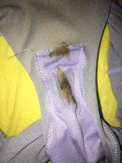 昨天下午有分泌物 现在又有点分泌物 好担心啊