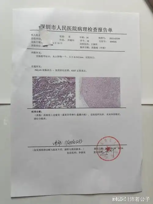 对比三甲医院胰腺癌鼻咽住院癌膀胱癌宫颈癌门诊病假病历怀孕血检对比