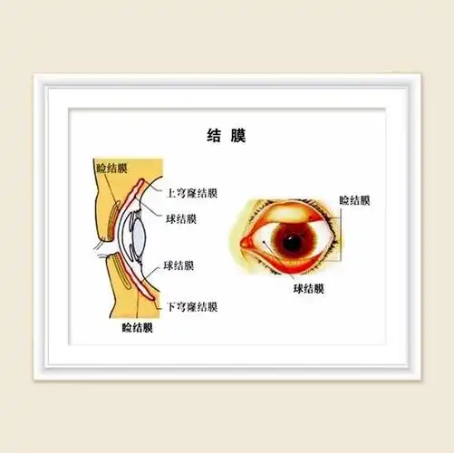 眼结膜与术后结膜脱垂的处理