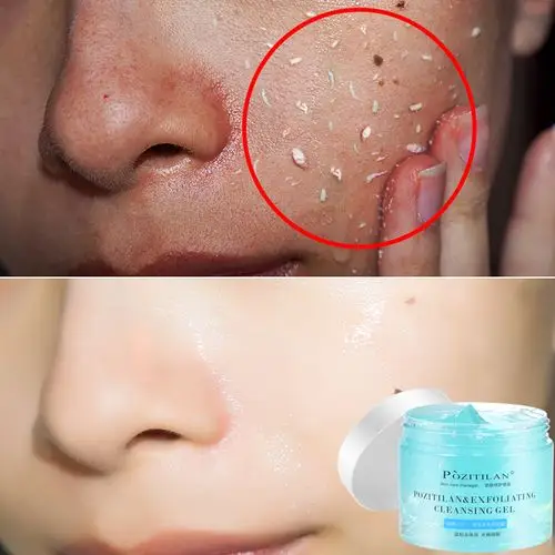 泊紫汀兰 去角质素面部脸部全身身体啫喱去死皮黑头磨砂膏男女士