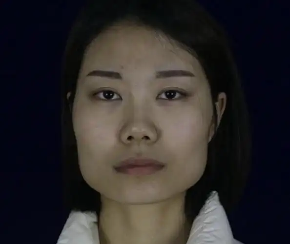 咬肌大颧骨高的图片