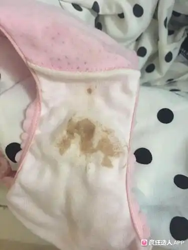 排卵第13天,流了一点点粉色的分泌物,大家怀孕有流过类似的吗?