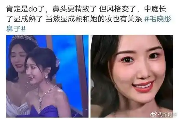 揭秘35岁毛晓彤被曝整容真实内幕|毛晓彤|整容|鼻子_新浪新闻