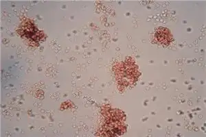 细胞凝集反应的应用