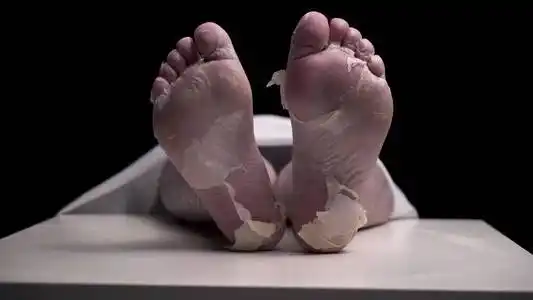 死于疾病的女孩或男孩的腿被放在停尸房的白色毯子下.