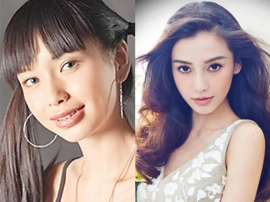 伊能静否认整容称只是戴了牙套,理由跟杨颖一样,你们信吗?