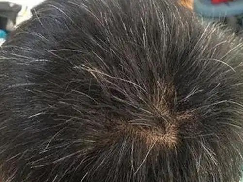 精血不足白发生,每天吃一点它,不到几毛钱,不到一个月白发变黑发!