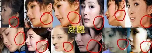 杨幂整过容吗整容换一张脸多少钱