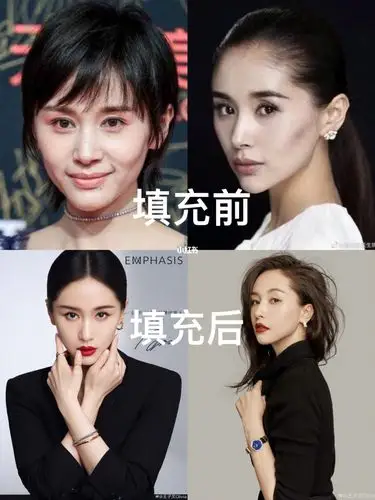 高级感美女_美女_颧骨_女明星_变美_红脸_王子文_美商_美妆_医美整形