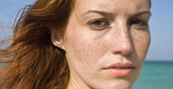 皮肤暗黄有斑怎么办