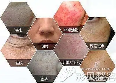 面部出现的多种皮肤问题