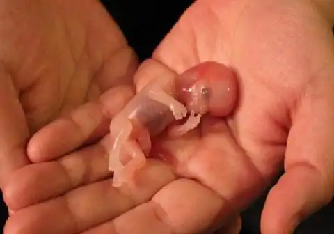 那些被流掉的胎儿他们是无辜的如果你没有准备不要早孕