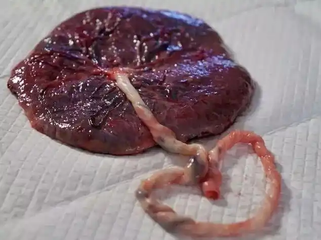 胎盘已被全世界人民吃出花样但这可能是有害的