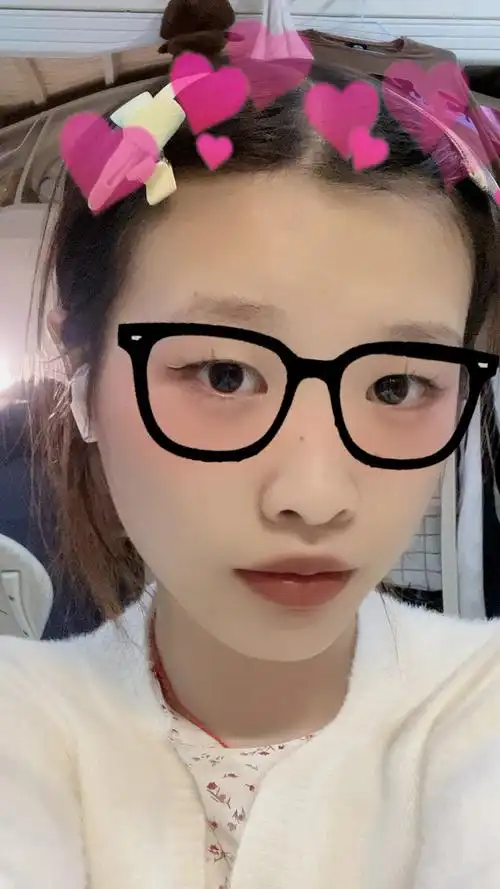 19岁在校女大学生(为什么我会有鱼尾纹?我该怎么办捏?