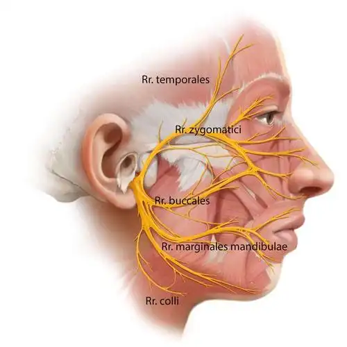 面神经由脑桥发出,是第七对颅神经,与位听神经一起进入内耳门
