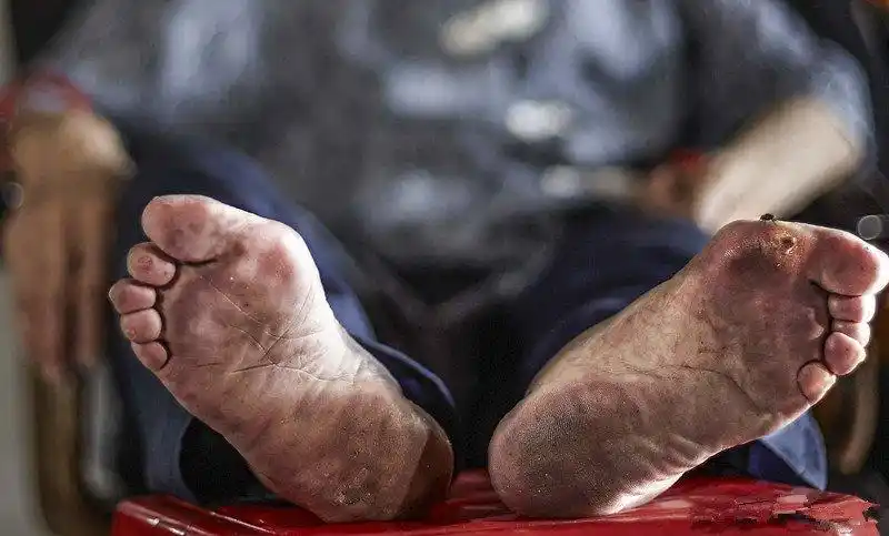 镜头下:即将消失的小脚女人