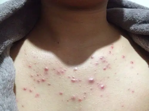 是什么原因啊.怎么办.谁能帮帮我