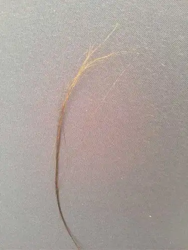 在头上随便一看就有这么多发根枯萎的头发,发根2-5厘米处枯萎发白,发