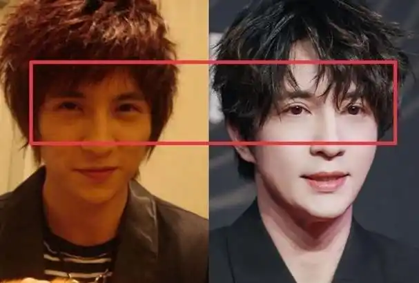 整容的5位男星削骨打针垫鼻梁样样不手软天然脸不好吗