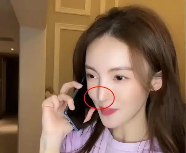 而且金晨的鼻子已经影响日常生活了,直播里她的鼻子捏一下就会紧紧贴