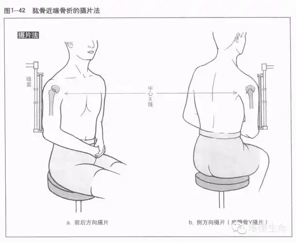 肩关节x线检查体位大全 - 好医术早读文章 - 好医术-赋能医生守护生命