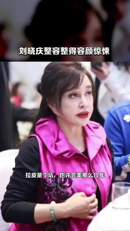 刘晓庆整容整得容颜惊悚