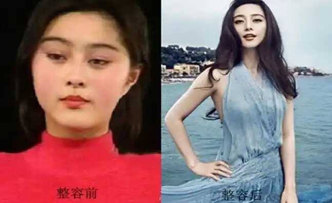 明星整形前后对比图 范冰冰赵丽颖榜上有名