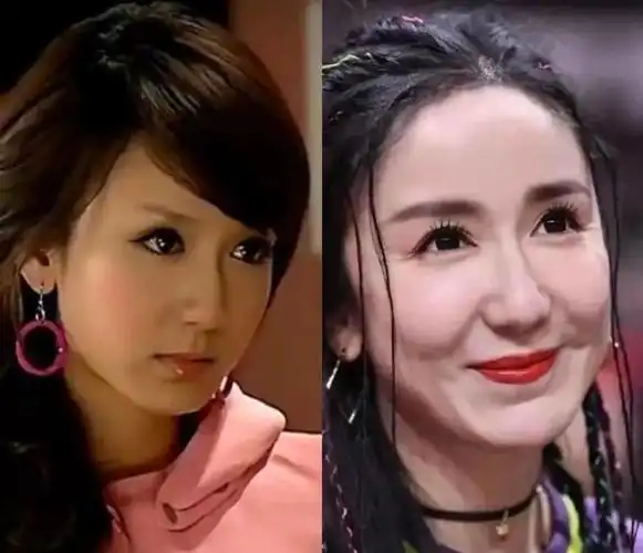 杨紫整容实锤  杨紫回应整形