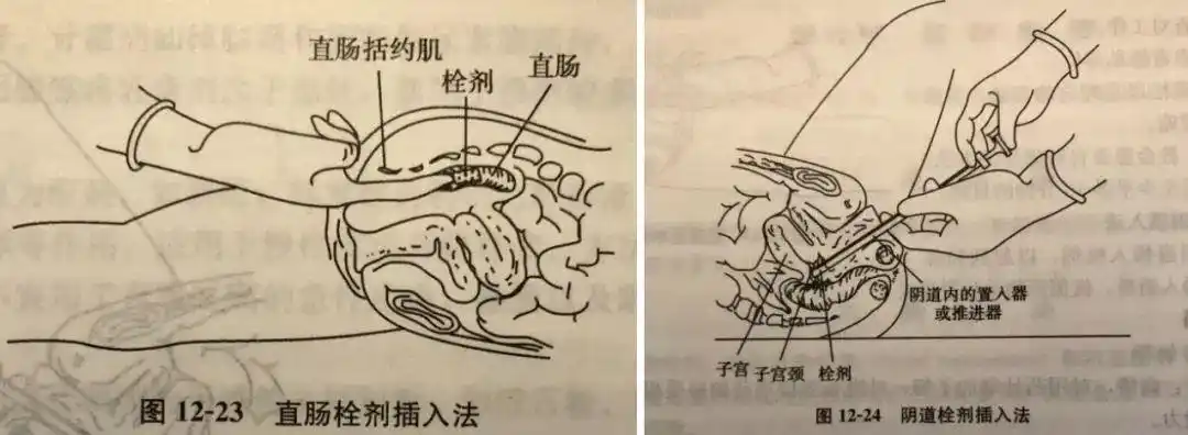 提醒:这一起给药差错使笔者想起了多年前曾听说过的一个案例:责任护士