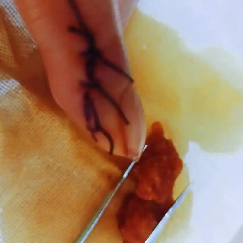 当刀子剁在手指上,无心一刀的时候,血就像喷泉一样喷涌而出,让 - 抖音