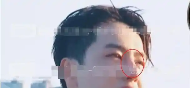 王一博又被疑整容?网友:鼻子透光了,这算是整容实锤了吧