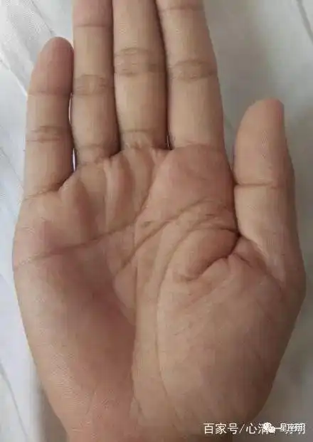 手相金星丘有横纹掌心向内凹陷出现三角纹财运比较旺