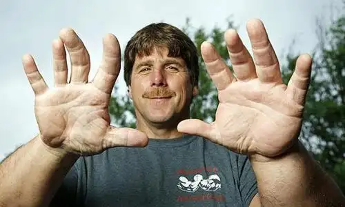 世界上最大的手指,食指甚至长达30厘米,整只手臂就20斤