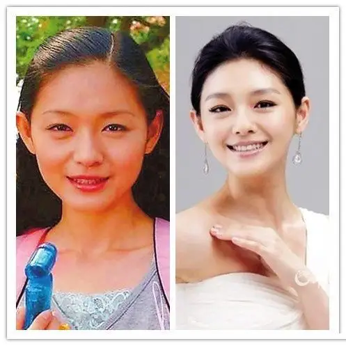 梁虹61护肤不想再当黑天鹅了那就赶紧白白白起来吧