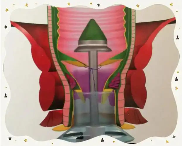 痔疮手术选择pph需谨慎