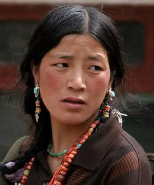 为何有人经常挂着两个红脸蛋