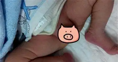 8个月男婴的"小弟弟"没了!医生:这个细小的东西要警惕