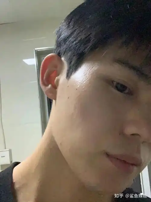 男生怎么把自己皮肤养得好好的