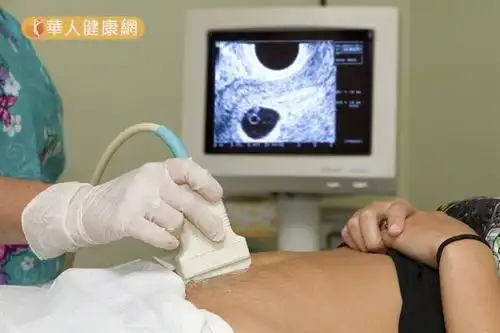 子宫异常出血3原因 | 王瑞生 | 女性泌尿生殖疾病 | 妇产科 | 健康新