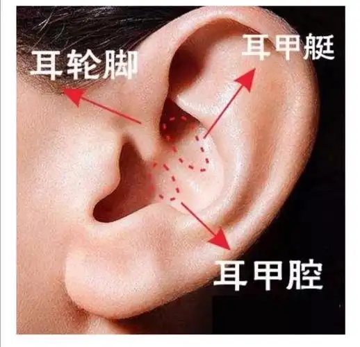 钟教授您好想请教您如果天生耳廓有异是否可以利用多余的这部