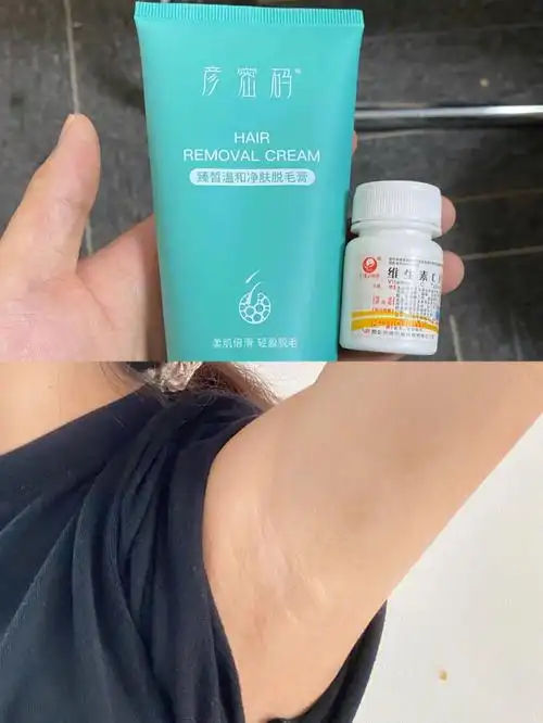 原来腋毛多真的要去医院啊